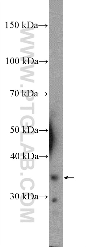 Western Blot (WB) analysis of HeLa cells using FUSIP1 Polyclonal antibody (10131-1-AP)