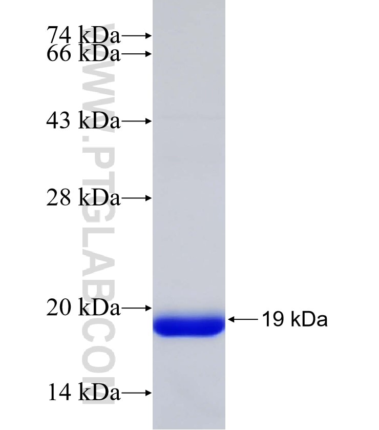 FUT1 fusion protein Ag33016 SDS-PAGE FUT1 fusion protein Ag33016 SDS-PAGE