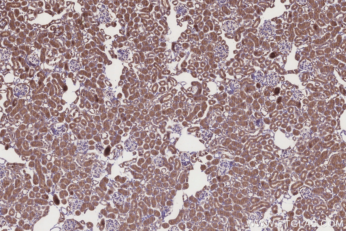Immunohistochemistry (IHC) staining of mouse kidney tissue using FUT10 Polyclonal antibody (18660-1-AP)