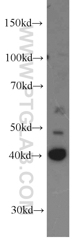 WB analysis of HeLa using 18660-1-AP (same clone as 18660-1-PBS) Western Blot (WB) analysis of HeLa cells using FUT10 Polyclonal antibody (18660-1-AP)