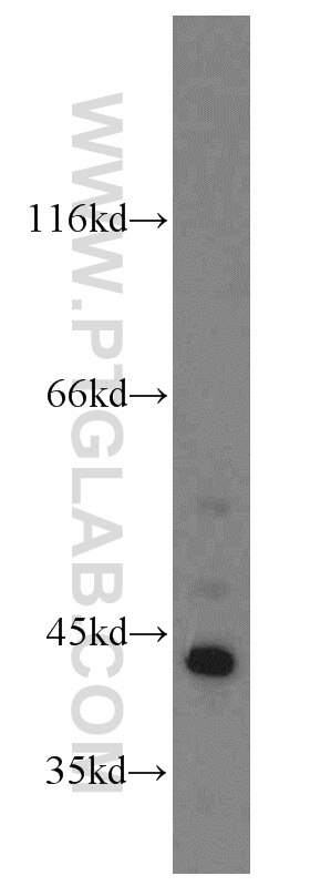 Western Blot (WB) analysis of HeLa cells using FUT10 Polyclonal antibody (18660-1-AP)