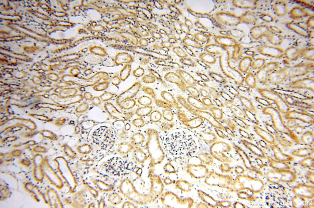Immunohistochemistry (IHC) staining of human kidney tissue using FUT11 Polyclonal antibody (17175-1-AP)