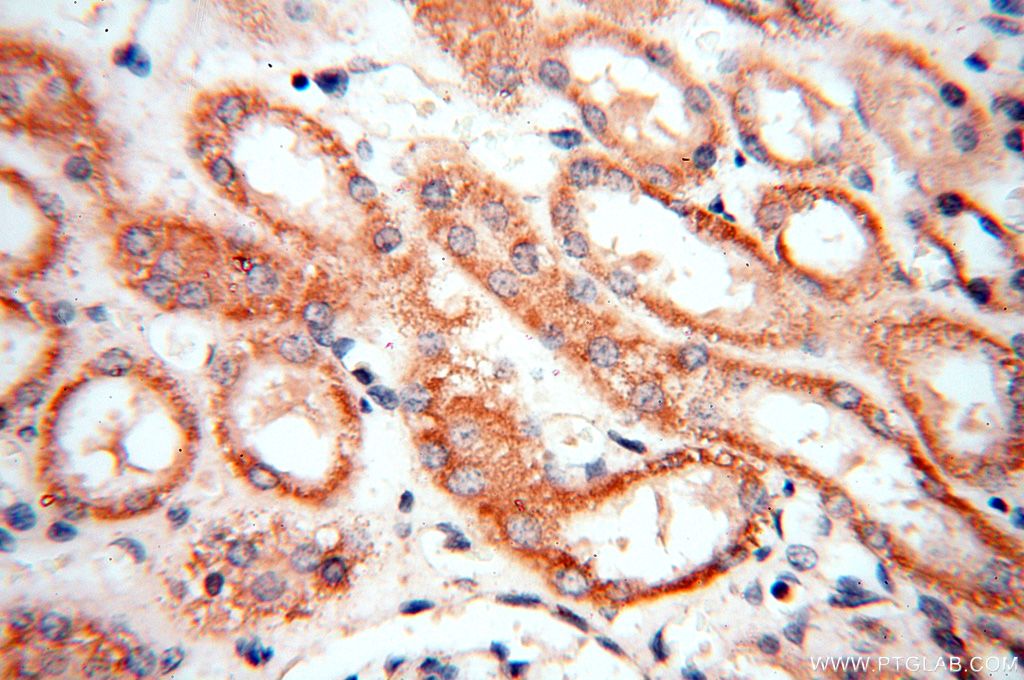 IHC staining of human kidney using 17175-1-AP