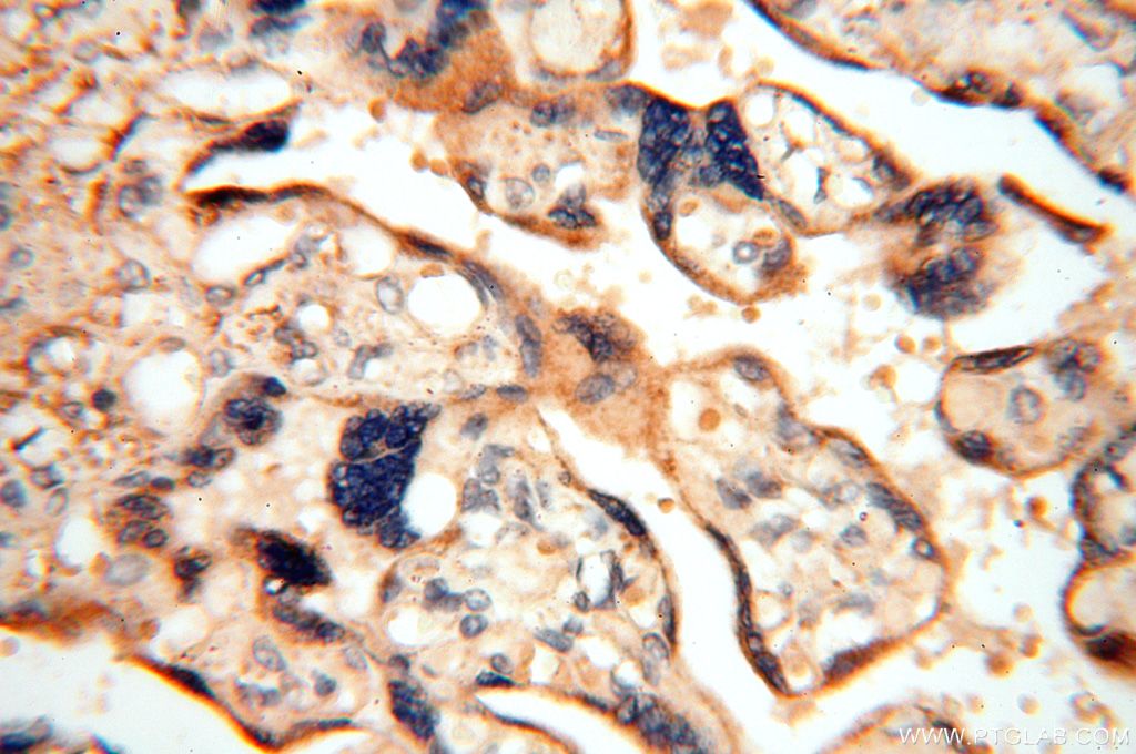 Immunohistochemistry (IHC) staining of human placenta tissue using FUT11 Polyclonal antibody (17175-1-AP)