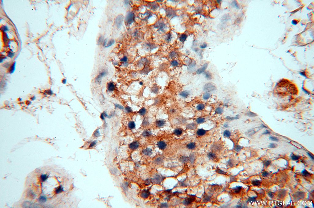 Immunohistochemistry (IHC) staining of human testis tissue using FUT11 Polyclonal antibody (17175-1-AP)