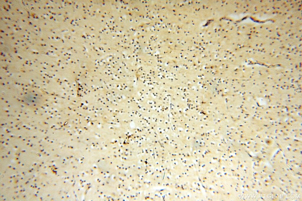 Immunohistochemistry (IHC) staining of human brain tissue using FUT11 Polyclonal antibody (17175-1-AP)