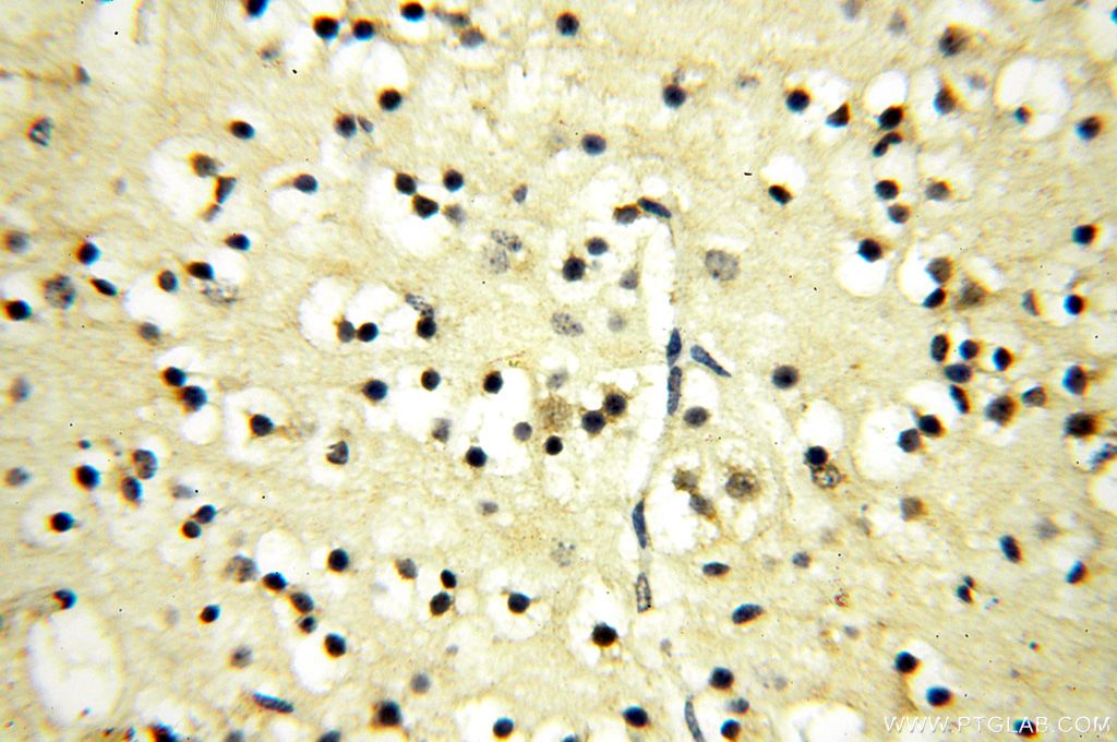 Immunohistochemistry (IHC) staining of human brain tissue using FUT11 Polyclonal antibody (17175-1-AP)