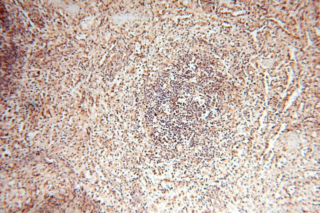 Immunohistochemistry (IHC) staining of human spleen tissue using FUT11 Polyclonal antibody (17175-1-AP)