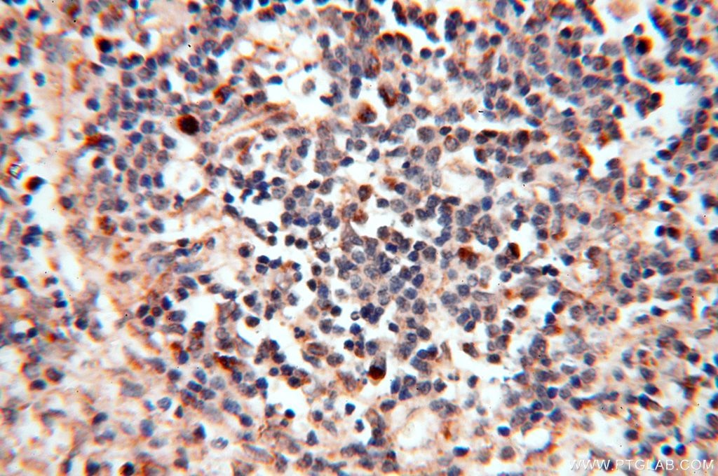 Immunohistochemistry (IHC) staining of human spleen tissue using FUT11 Polyclonal antibody (17175-1-AP)