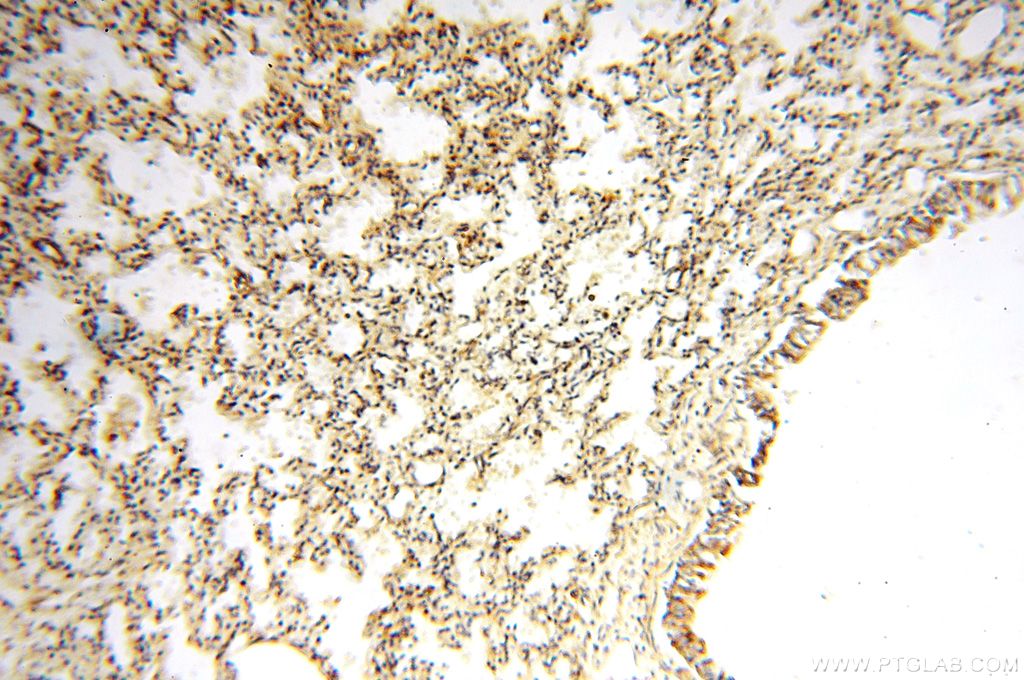 Immunohistochemistry (IHC) staining of human lung tissue using FUT11 Polyclonal antibody (17175-1-AP)