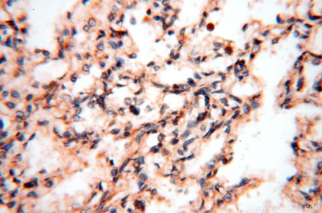 Immunohistochemistry (IHC) staining of human lung tissue using FUT11 Polyclonal antibody (17175-1-AP)