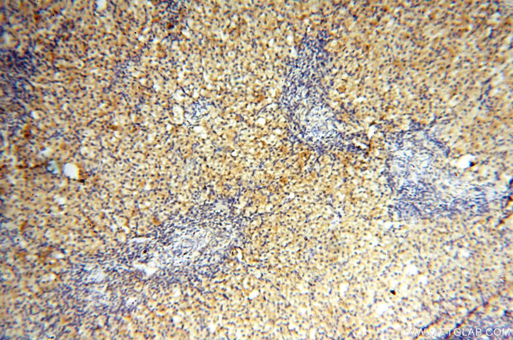 Immunohistochemistry (IHC) staining of human ovary tissue using FUT11 Polyclonal antibody (17175-1-AP)
