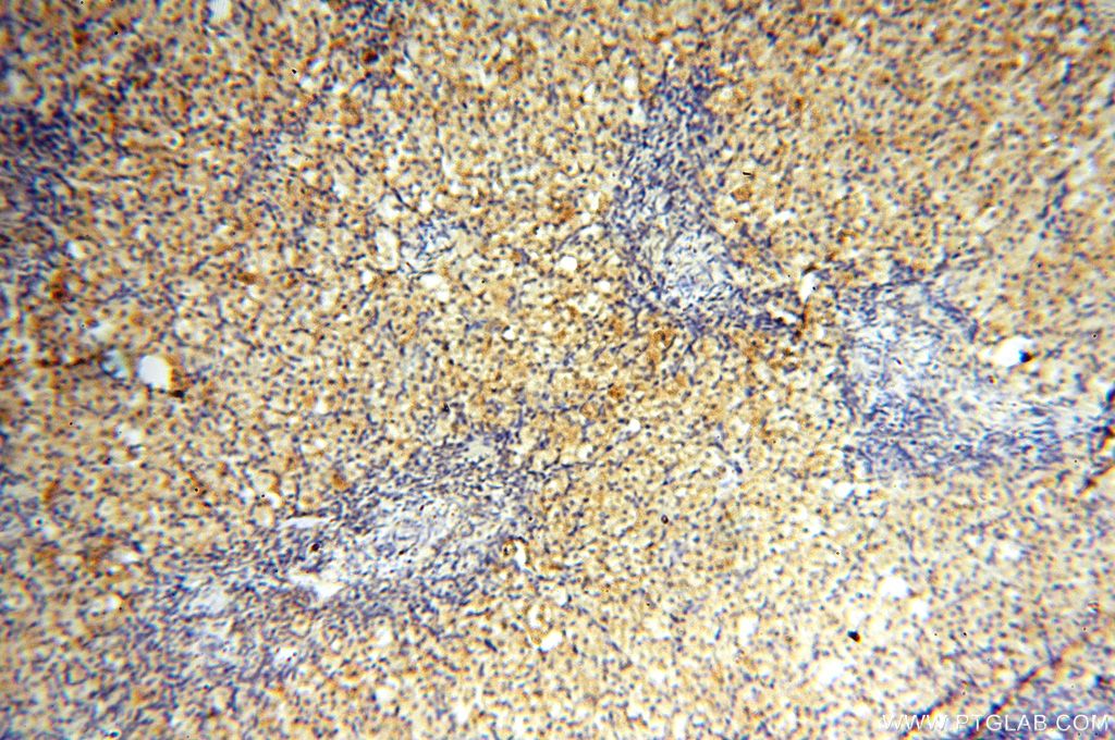 IHC staining of human ovary using 17175-1-AP