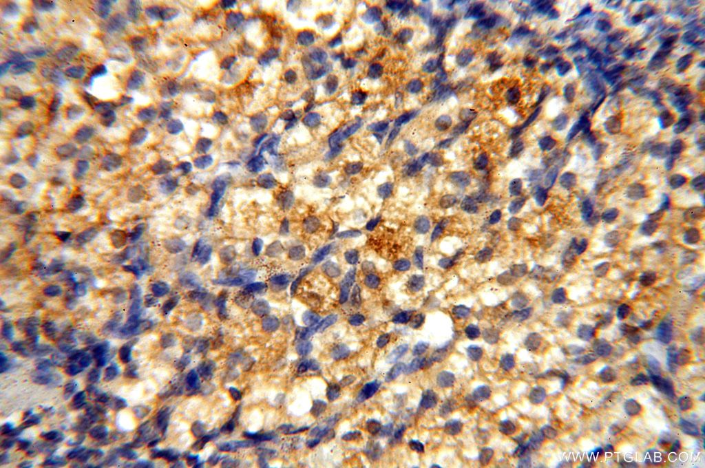 Immunohistochemistry (IHC) staining of human ovary tissue using FUT11 Polyclonal antibody (17175-1-AP)