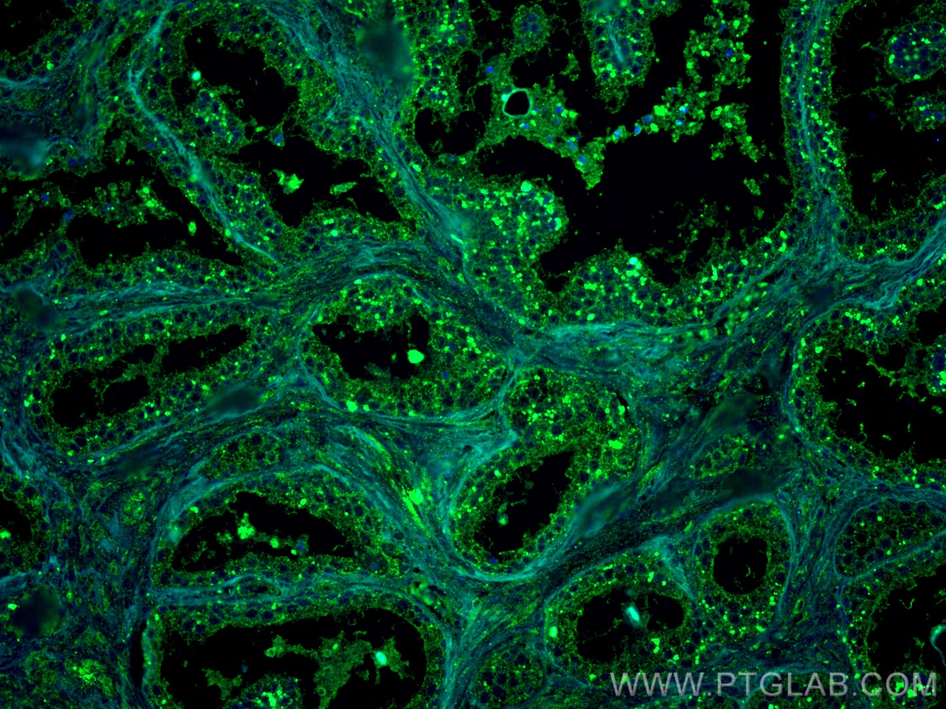 Immunofluorescence (IF) / fluorescent staining of human prostate hyperplasia tissue using FUT3 Monoclonal antibody (67344-1-Ig)