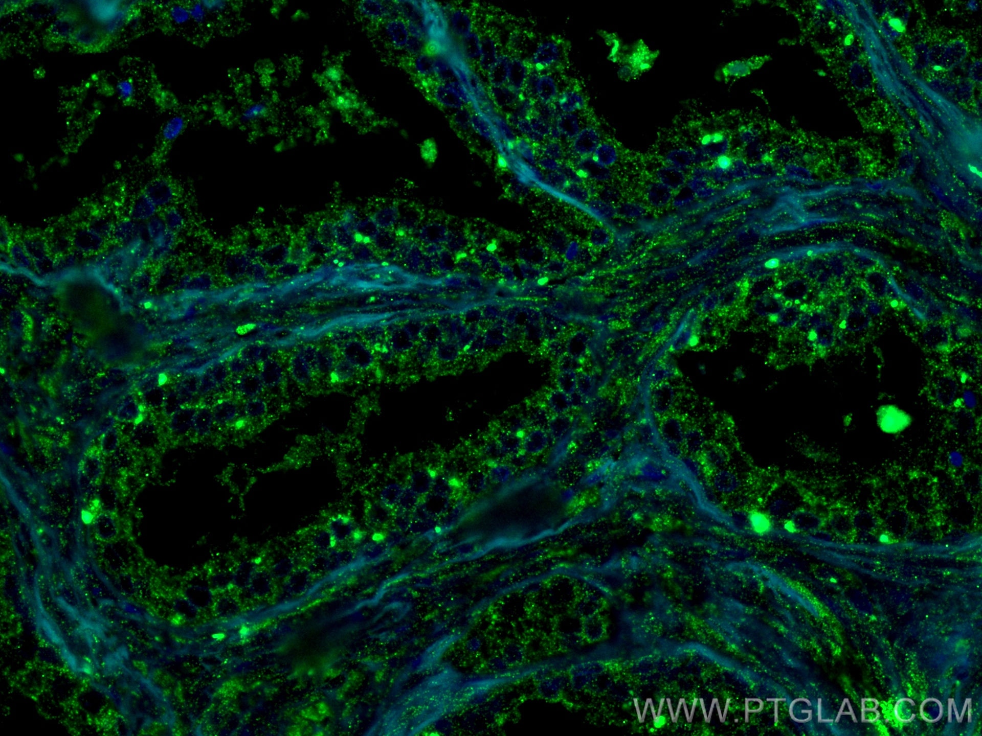 Immunofluorescence (IF) / fluorescent staining of human prostate hyperplasia tissue using FUT3 Monoclonal antibody (67344-1-Ig)