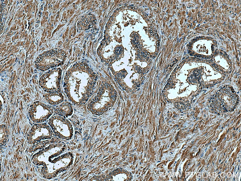 Immunohistochemistry (IHC) staining of human prostate hyperplasia tissue using FUT3 Monoclonal antibody (67344-1-Ig)