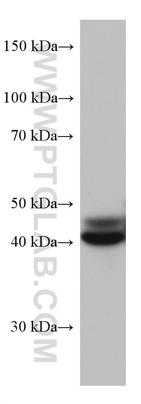 WB analysis of JAR using 67344-1-Ig
