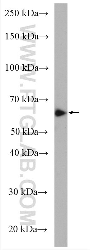 Western Blot (WB) analysis of Jurkat cells using FUT4 Polyclonal antibody (19497-1-AP)