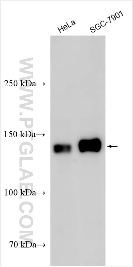 Western Blot (WB) analysis of various lysates using FUT4 Polyclonal antibody (19497-1-AP)