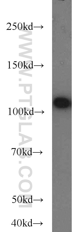 Western Blot (WB) analysis of HeLa cells using FUT4 Polyclonal antibody (19497-1-AP)
