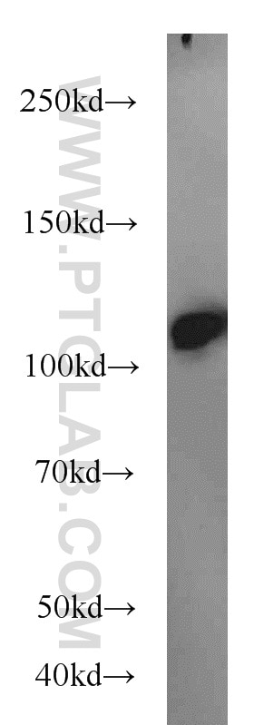 Western Blot (WB) analysis of HL-60 cells using FUT4 Polyclonal antibody (19497-1-AP)