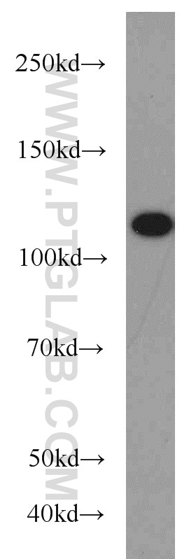 Western Blot (WB) analysis of Jurkat cells using FUT4 Polyclonal antibody (19497-1-AP)