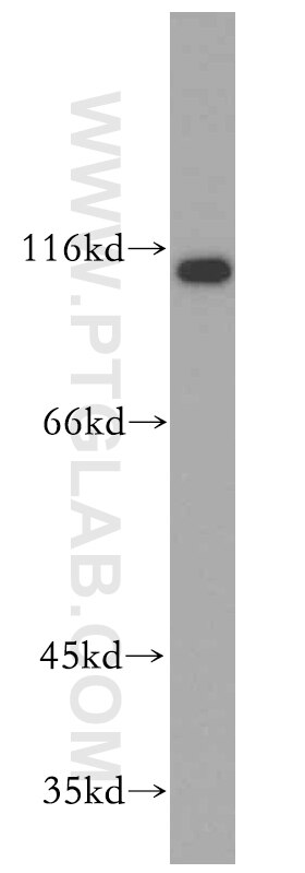 Western Blot (WB) analysis of HepG2 cells using FUT4 Polyclonal antibody (19497-1-AP)