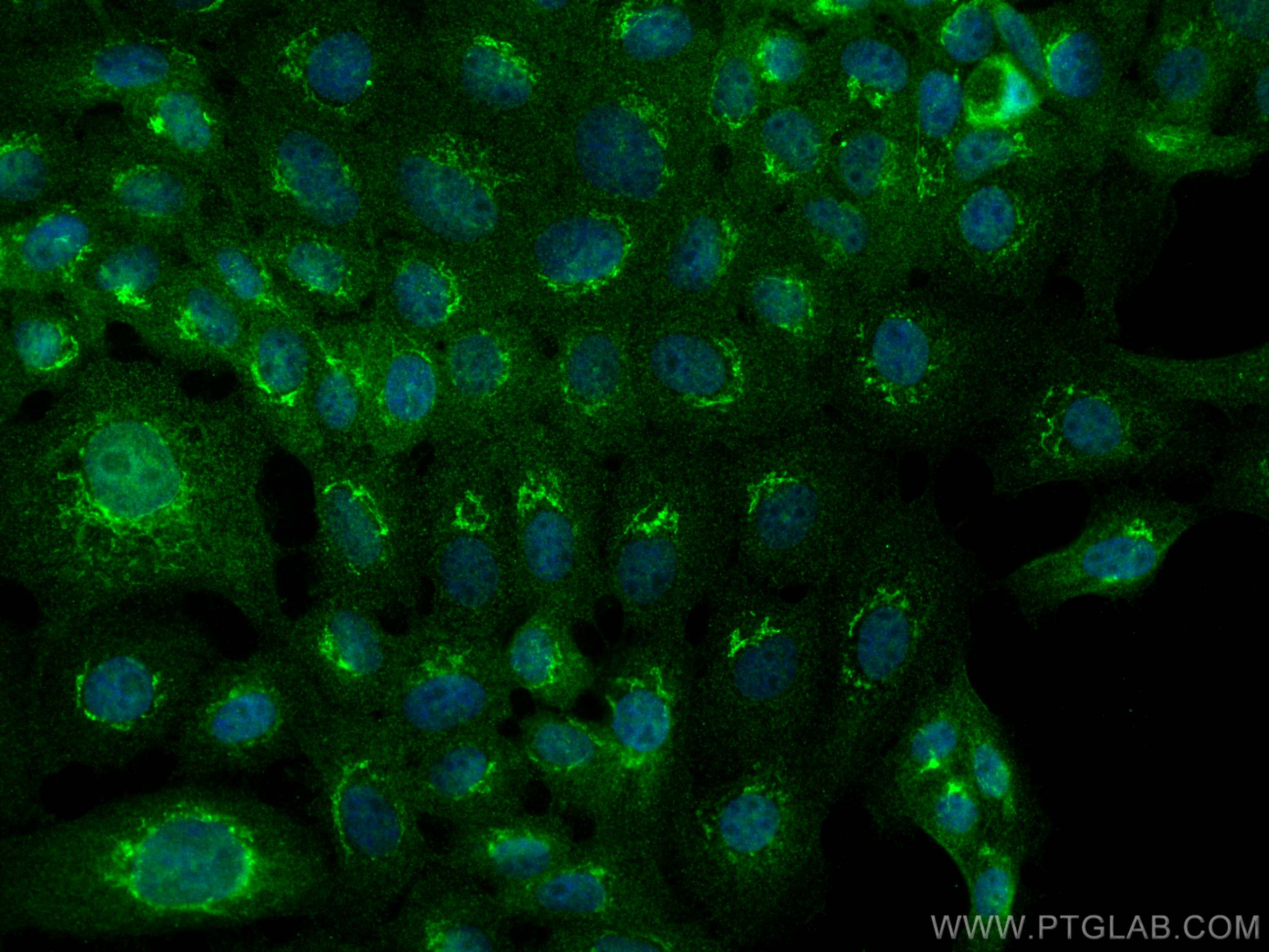 Immunofluorescence (IF) / fluorescent staining of A431 cells using FUT4 Polyclonal antibody (22141-1-AP)