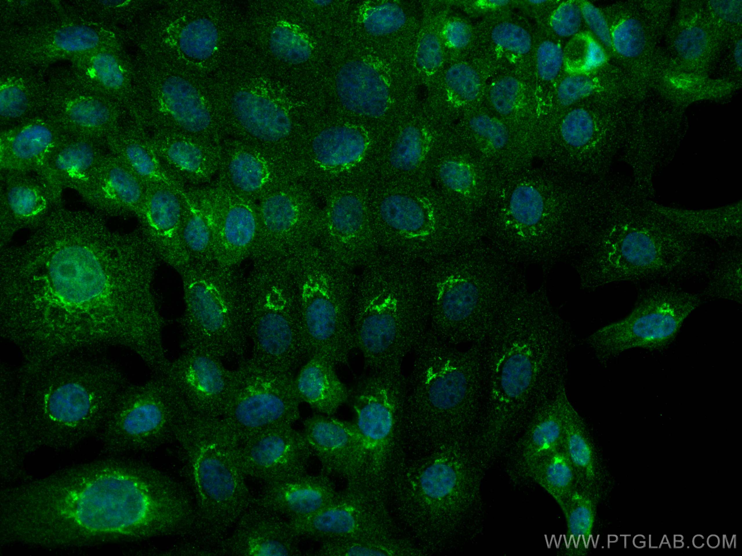 IF Staining of A431 using 22141-1-AP