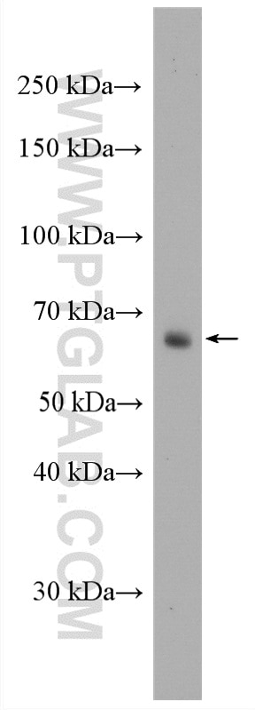 Western Blot (WB) analysis of Jurkat cells using FUT4 Polyclonal antibody (22141-1-AP)