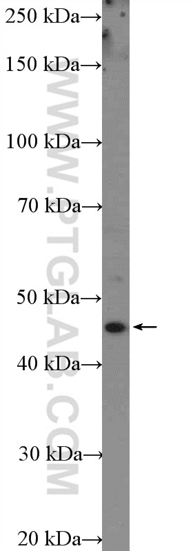 Western Blot (WB) analysis of A431 cells using FUT4 Polyclonal antibody (22141-1-AP)
