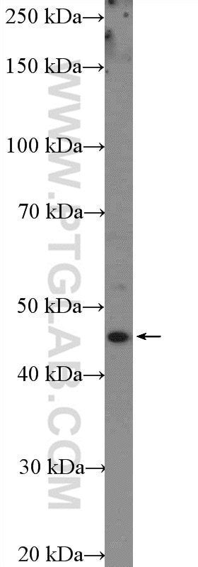 WB analysis of A431 using 22141-1-AP
