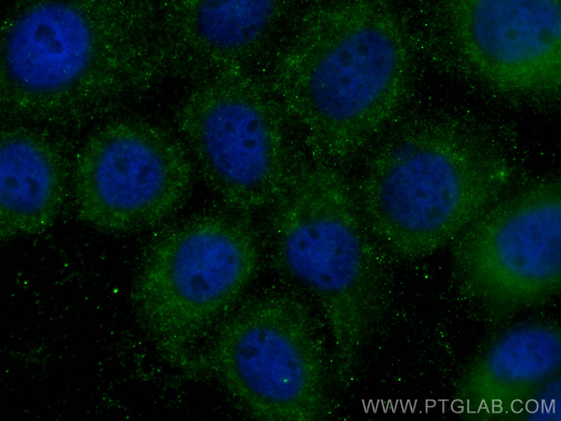 Immunofluorescence (IF) / fluorescent staining of A431 cells using CoraLite® Plus 488-conjugated FUT4 Polyclonal anti (CL488-22141)