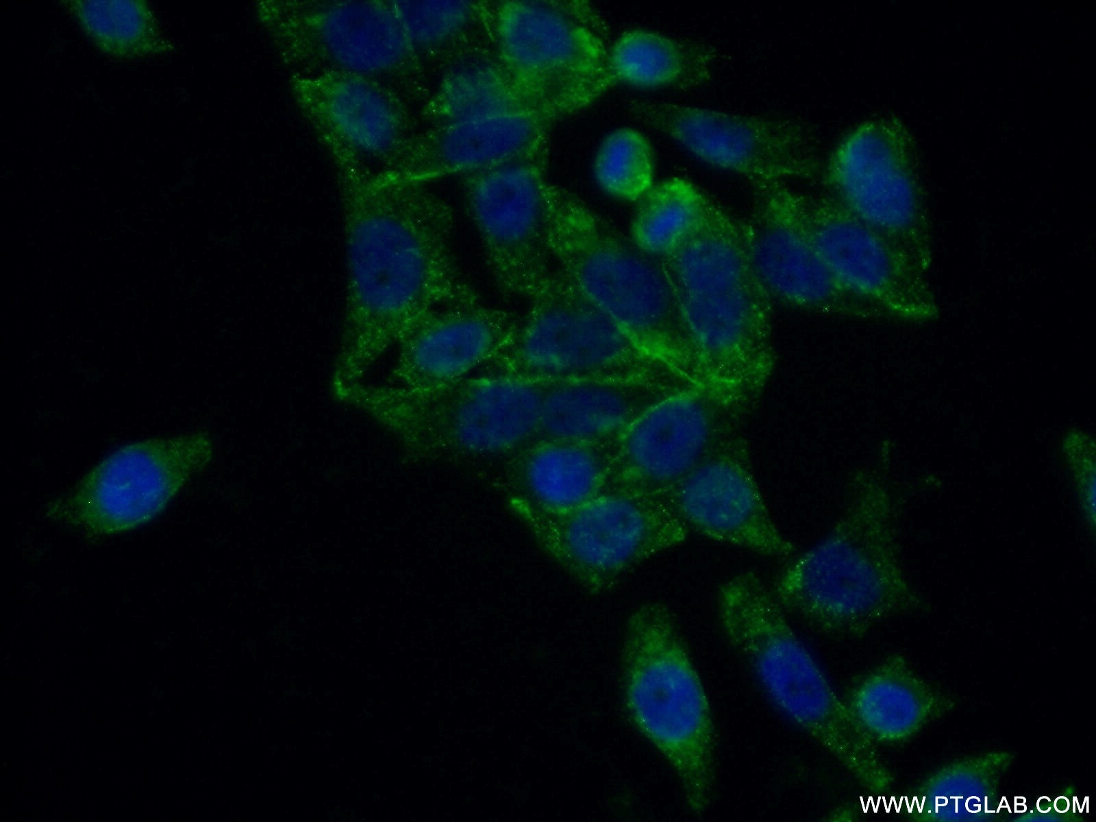 Immunofluorescence (IF) / fluorescent staining of HeLa cells using FUT6 Polyclonal antibody (16567-1-AP)