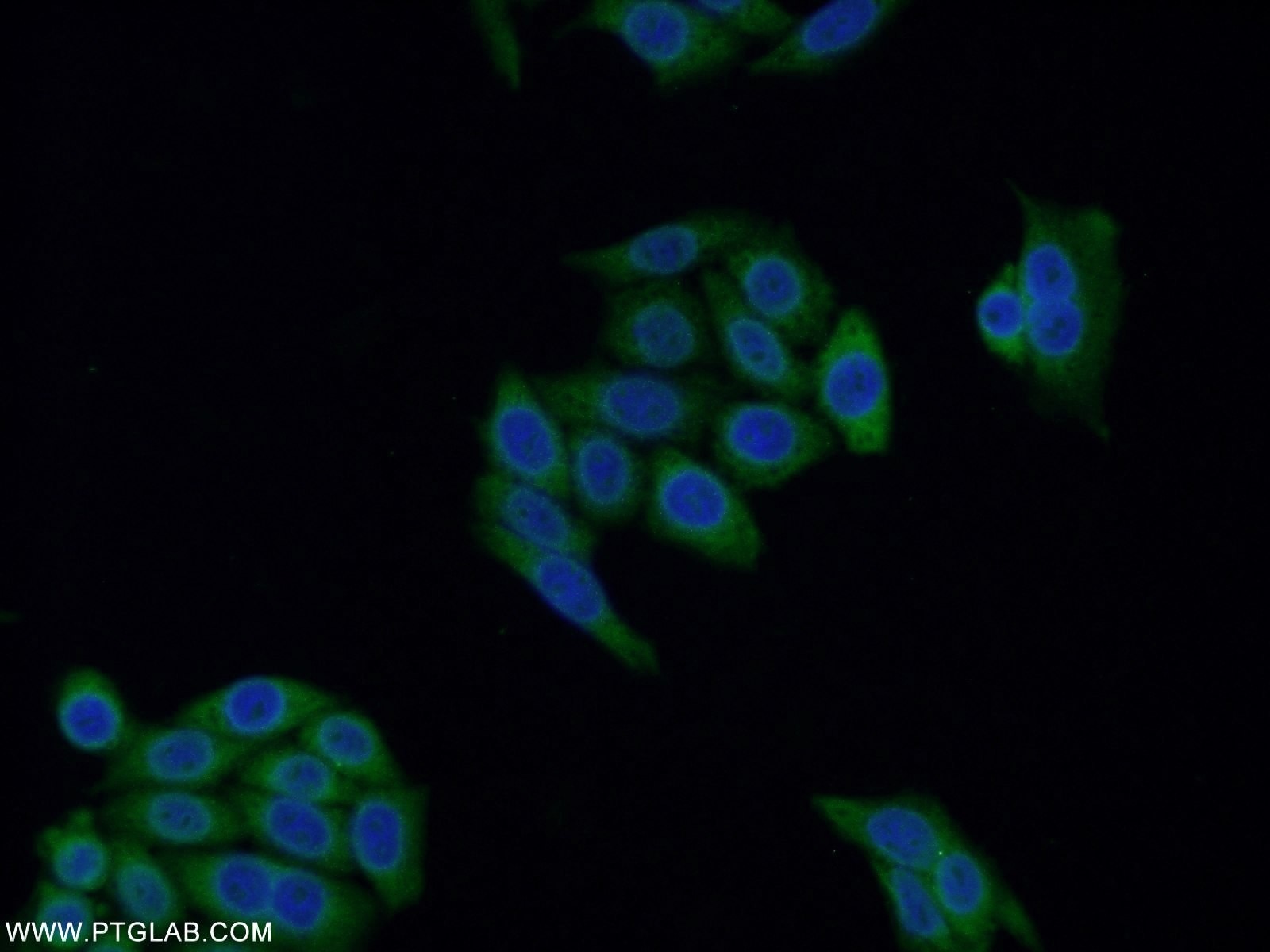Immunofluorescence (IF) / fluorescent staining of HeLa cells using FUT7 Polyclonal antibody (18197-1-AP)