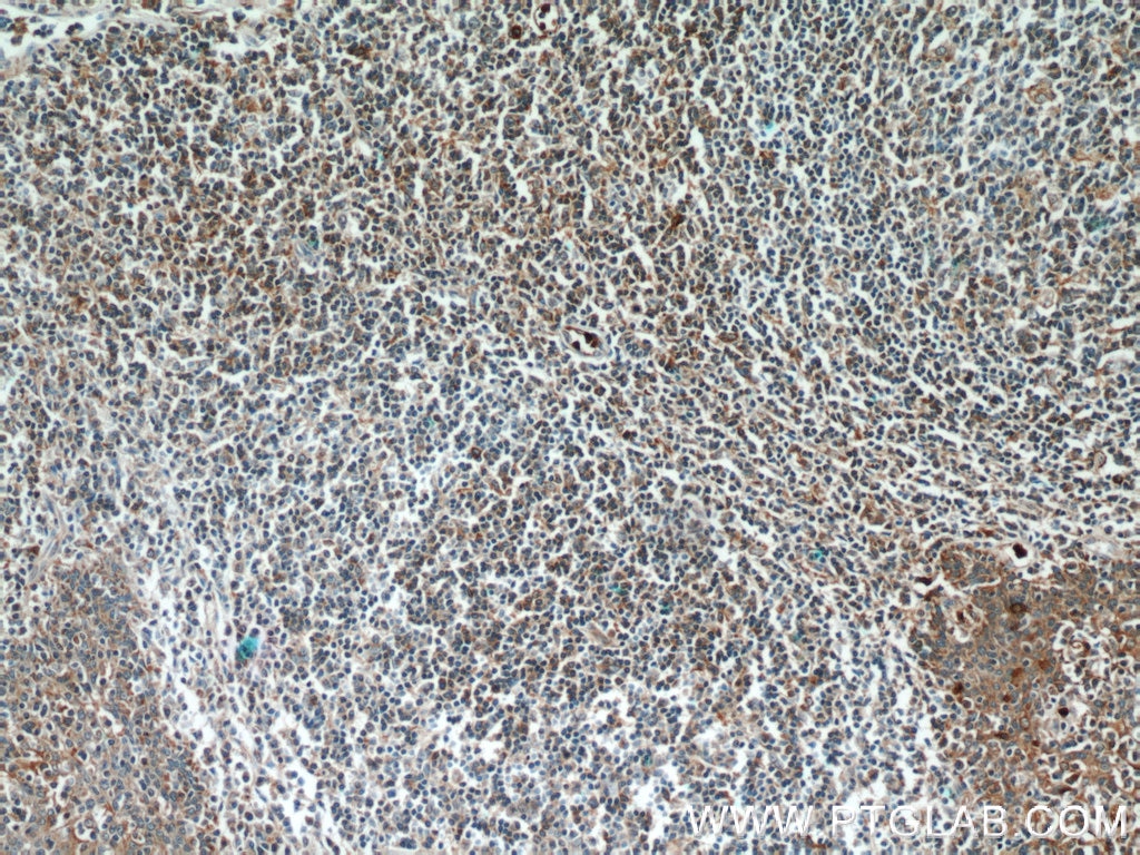 Immunohistochemistry (IHC) staining of human tonsillitis tissue using FUT7 Polyclonal antibody (18197-1-AP)