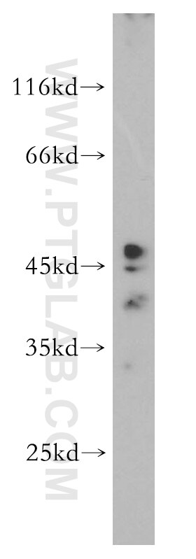 Western Blot (WB) analysis of HeLa cells using FUT7 Polyclonal antibody (18197-1-AP)