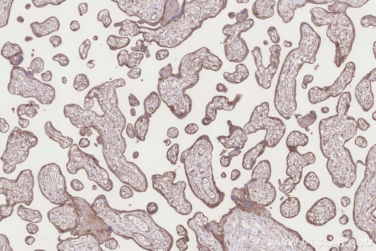 Immunohistochemistry (IHC) staining of human placenta tissue using FUT8 Polyclonal antibody (12560-1-AP)