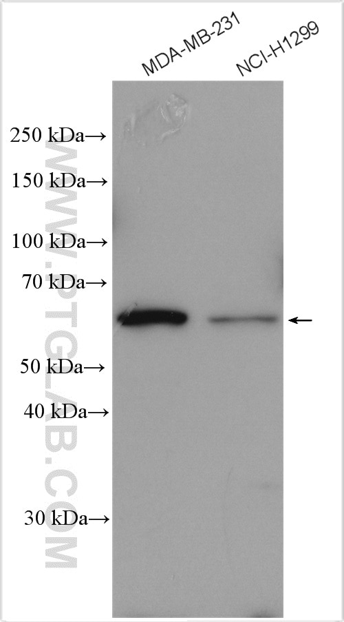 Western Blot (WB) analysis of various lysates using FUT8 Polyclonal antibody (29430-1-AP)
