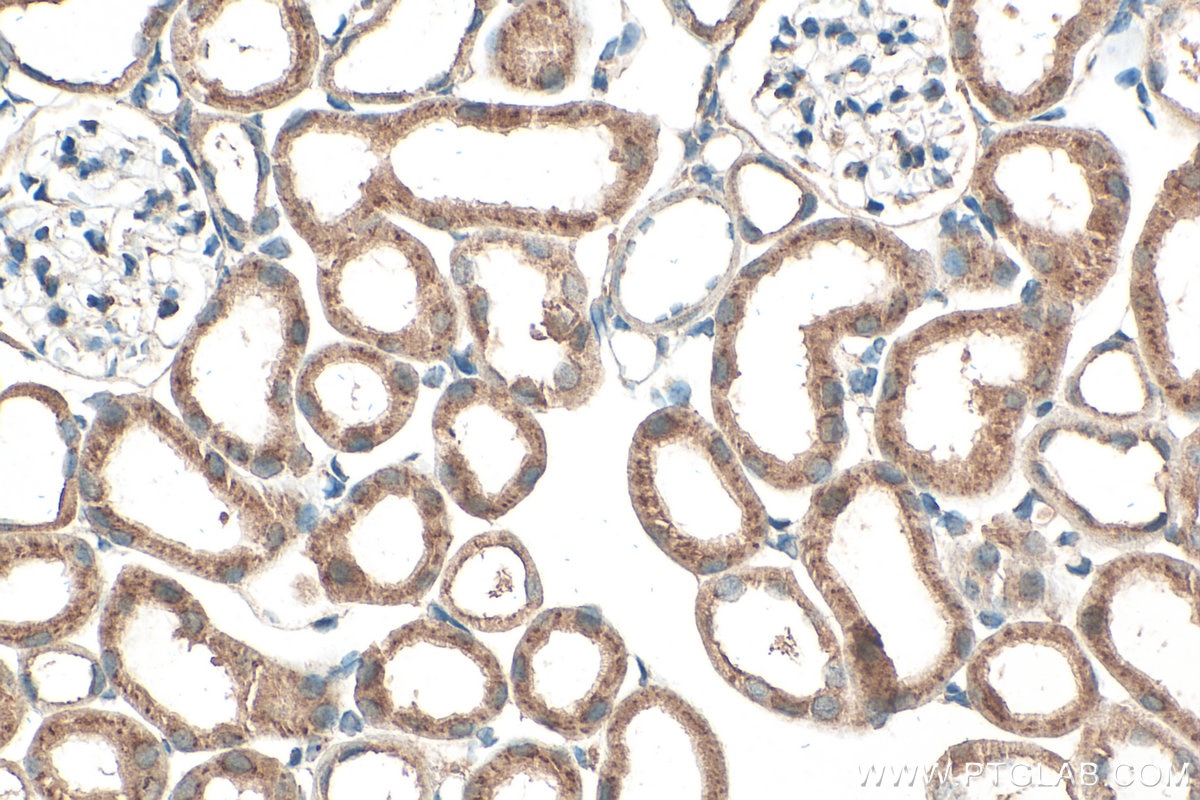 Immunohistochemistry (IHC) staining of mouse kidney tissue using FUT8 Monoclonal antibody (66118-1-Ig)