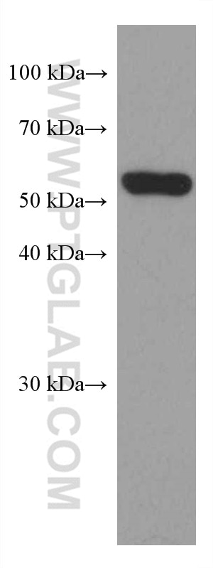 Western Blot (WB) analysis of MDA-MB-453s cells using FUT8 Monoclonal antibody (66118-1-Ig)