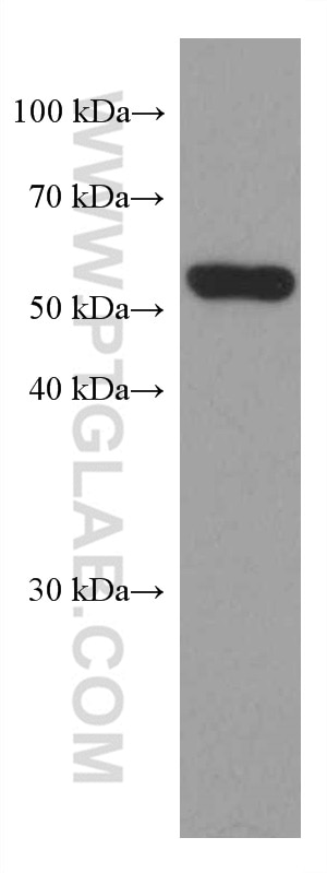 WB analysis of MDA-MB-453s using 66118-1-Ig