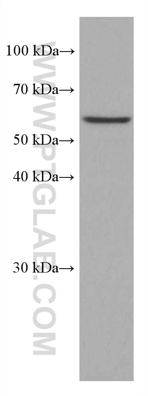 WB analysis of MDA-MB-231 using 66118-1-Ig