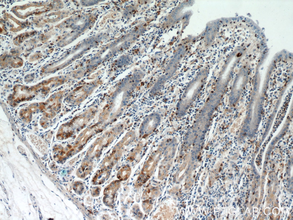 Immunohistochemistry (IHC) staining of human stomach tissue using FUT9 Monoclonal antibody (60230-1-Ig)