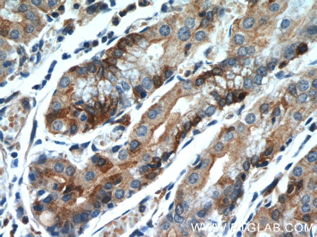 Immunohistochemistry (IHC) staining of human stomach tissue using FUT9 Monoclonal antibody (60230-1-Ig)