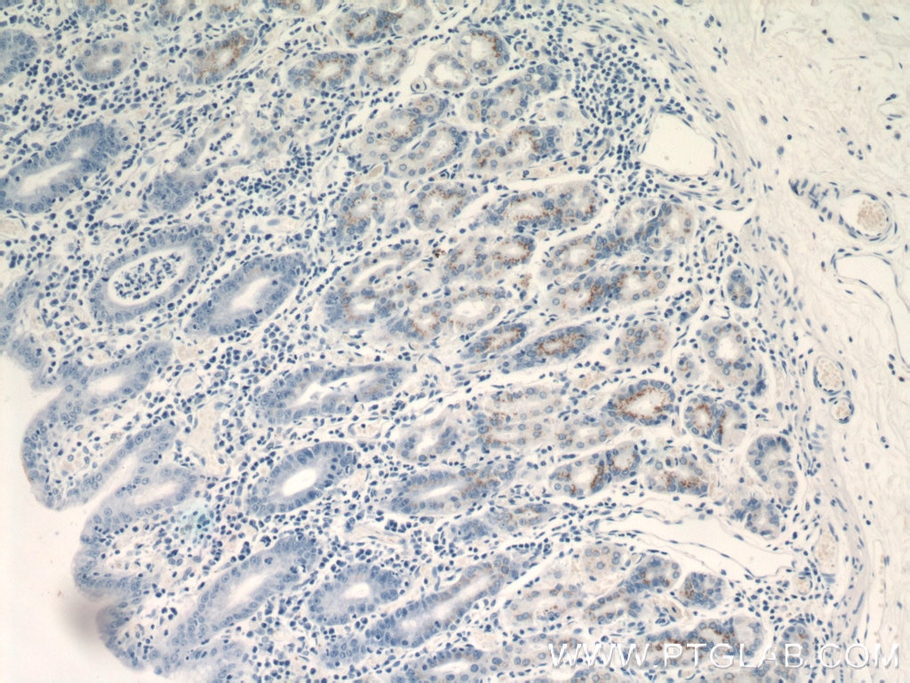 Immunohistochemistry (IHC) staining of human stomach tissue using FUT9 Monoclonal antibody (60230-1-Ig)