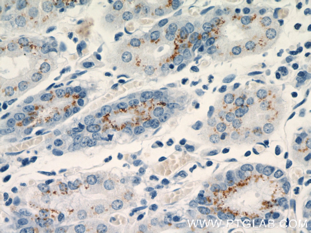 Immunohistochemistry (IHC) staining of human stomach tissue using FUT9 Monoclonal antibody (60230-1-Ig)