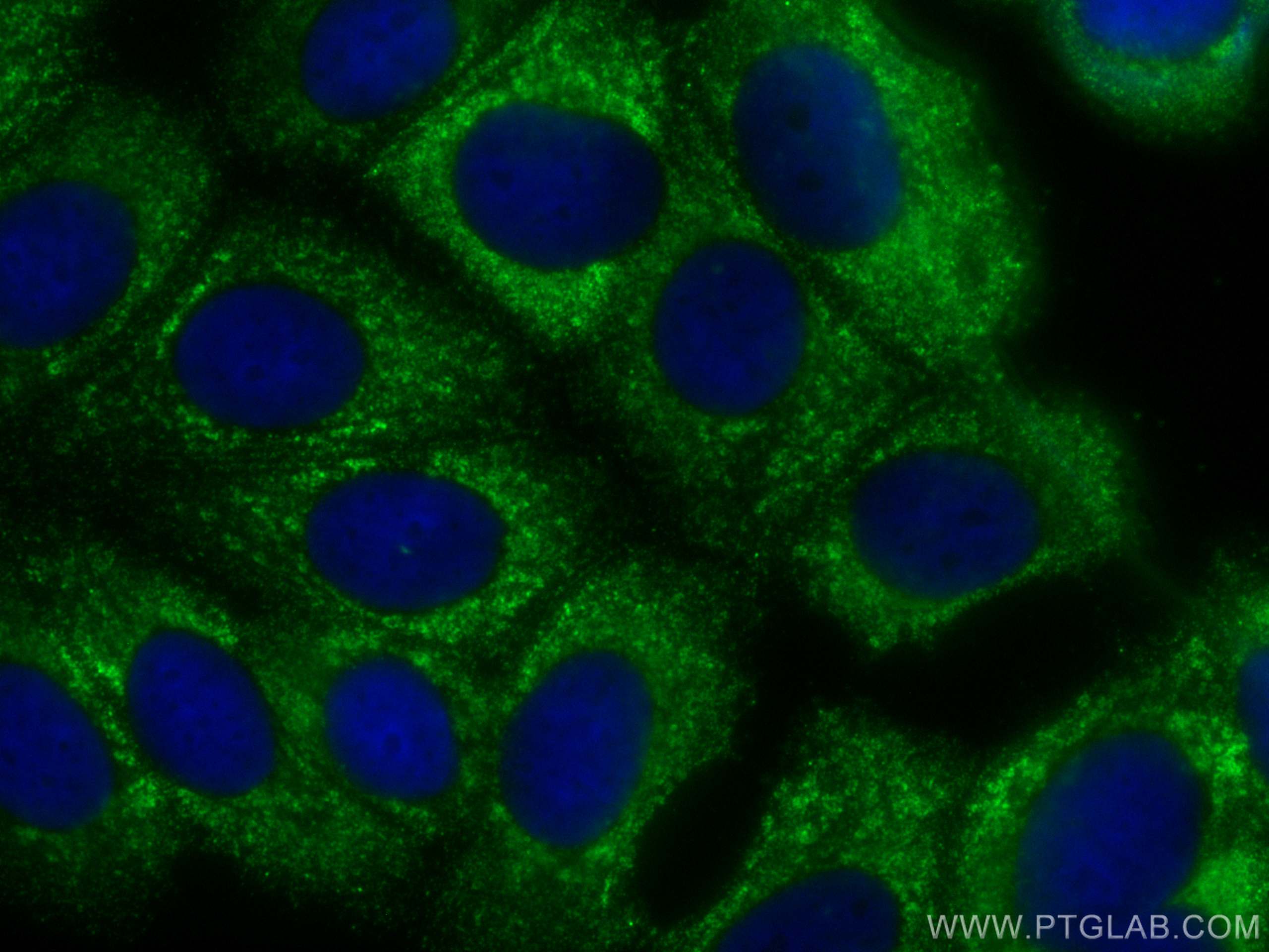 Immunofluorescence (IF) / fluorescent staining of MCF-7 cells using CoraLite® Plus 488-conjugated FUT9 Monoclonal anti (CL488-60230)