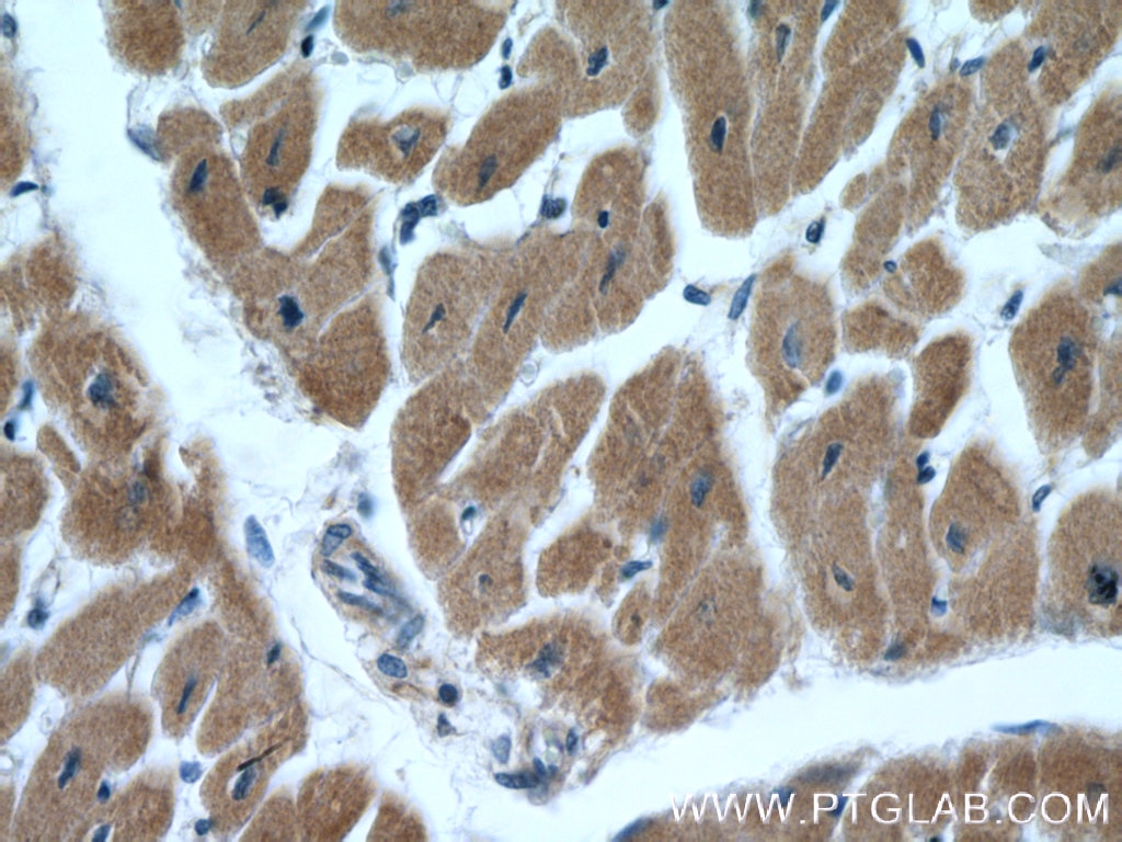 Immunohistochemistry (IHC) staining of human heart tissue using TIMM10B Polyclonal antibody (10907-1-AP)